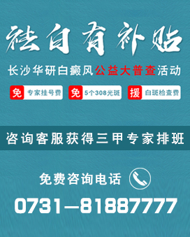 娄底治疗白癜风医院